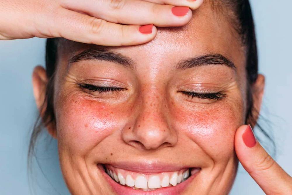 How to Get Rid of Dark Circles Under the Eyes